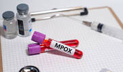 Debunking Common Myths About Mpox: What You Need to Know Debunking Common Myths About Mpox: What You Need to Know